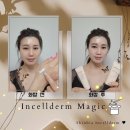 인셀덤매직