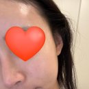 [서울/문정역] 하루미보떼 : 문정역에스테틱, 문정피부관리추천, 잠실피부관리, 잠실신부관리추천, 문정...