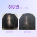 하루결 | 하루결*인천 서해구 가정동, 신현동 두피문신/SMP 후기