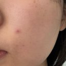 두정초등학교 | 천안 두정동 피부관리 에스테틱전문 [오마주21스킨케어]