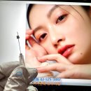 수아연한의원 | 마리오넷 주름 심술보 제거 후기 좋은 수아연한의원 시술만의 특징 2가지(경과사진 촬영ㅣ셀프시술)