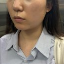 온엔뷰티 | [봄엔뷰티] 중동피부관리 추천 / 수기전문 상동피부관리 에스테틱