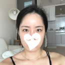 분성한의원 | 안면비대칭교정 한의원 방문 상담 후기