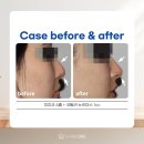 더샤인원 이미지