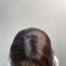솔헤어(sol hair) | 마산두피 내서 솔뷰티 SMP | 비어 보이던 정수리 고민 1회차 후기