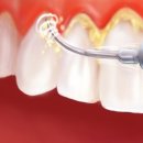 지안치과 이미지