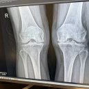 바른병원 | 바른마디 병원 방문 후기!! (최악이다!)