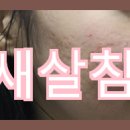 깊은 여드름 흉터치료를 위한 효과적인 방법, 피부과와 한의원에서 진행하는 새살침 후의 변화를 살펴보자.