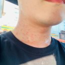 선릉역 왁싱 추천 쥐젖 제거 실면도 후기 테오트리 강남점