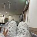 이따금식 | 우측 제5중족골 기저부 골절_수술 후기 3 (완결, 핀제거수술)