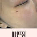 점.하나