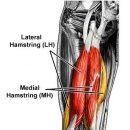 The management of hamstring injury—Part 1, 2 - 논문 2개 번역해야 수련의 이미지