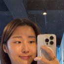 백승일의 참정형외과의원 | 청주smp 가르마 헤어라인 밀도 보강 잘하는 곳 SMP STUDIO(가는 길, 전후 사진)