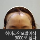 이마 이미지