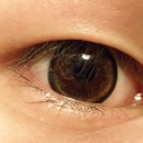 티탑콘텍트 이미지