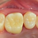 다올치과기공소 이미지