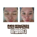 비엘메디칼 | 두정동피부관리 끝판왕 비엘뷰티 여기야