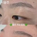 샵 속눈썹