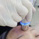 마산 여드름·기미 착색관리 후기! 수뷰티 피부톤 개선 효과 대박이었어요