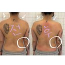 UR(강릉시)-[수리골길]-상-2 | 강릉 피부관리 뷰티다룸 강릉교동점에서 상체 테라피 후기