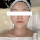 파티마피부관리실 | 대구 피부관리실 작은 얼굴 관리 케어 후기 뷰티로다