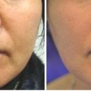 샘물한의원 이미지