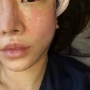 케이트의원 | 10살 어려보이는 비결 쥬베룩 울트라콜 포텐자 후기