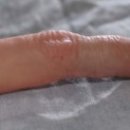 중앙의지보조기 이미지