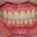 맥치과기공소 이미지