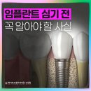 보은치과의원 | 이빨 전체임플란트 절차 요약 정리