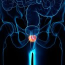 Refine dog 이미지