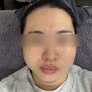 송내프라자 | 부천송내역피부관리 새로고침에서 재생관리 받고 피부 광채 되찾은 후기