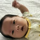 DDR | 제왕절개 흉터 DDR레이저후기 (켈로이드) 내돈내산