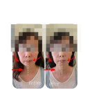 동탄 전신관리 추천 리바이브힐링센터의 자가에너지 테라피 후기