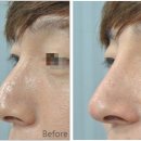 비엔에프의원 이미지