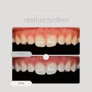 서울리치과의원 이미지