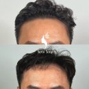 다루헤어 이미지