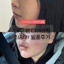 굿포유피부과의원 | 대구온다리프팅 내돈내산 최저가 발품후기 시지피부과 리쥬엘