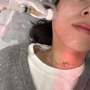 강남역 피부한의원 엑소좀 주사 기미색소 컨택터 후기