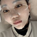 용산역피부과 슈링크유니버스 효과 전후 내돈내산 후기