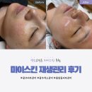 차스킨광주점 | 광주 풍암동 잡티고민 마이스킨 재생관리 비교 후기