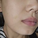 행복한 멍이세상 | 옆볼 앞볼 팔자 스컬트라 가격 좋았던 효과 후기