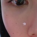 내돈내산, 여드름스팟에 진정 콕! 다이소 에이솔루션 어성초칼라민 진정콕스팟 사용법, 후기