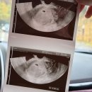 동해시-35 | 임신 기록 | 동해시 보건소 임산부 등록 및 국민행복카드 신청후기