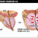 미운 이미지