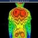 우리들척추운동센터 이미지