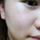 그린메디랩 | 촉촉한 파운데이션 추천 :: 데이셀 메디랩 블랙로즈 쿠션파운데이션