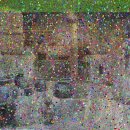 복코돼지 | 복코수술후기 퍼진 코끝 개선 변화를