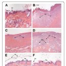 상처 치유를 촉진하는 병풍추출물(Centella asiatica)에 대한 논문 이미지