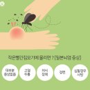 일본뇌염 바이러스 옮기는 모기, 11월까지 조심해야 한다? 이미지